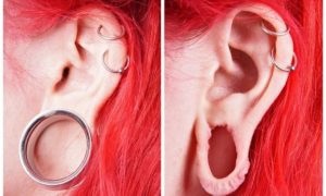 "A young man has opened a flesh tunnel in his earlobe 1.5 inches wide."