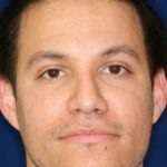 Closed Rhinoplasty - Lowered Bridge, raised and refined tip - Headshot Face- After Pic - Beverly Hills Rhinoplasty Superspecialist